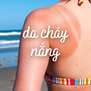 Tia-UV-va-kem-chong-nang
